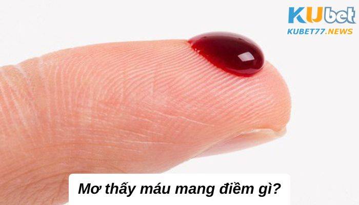 Mơ thấy máu với những giải mã hay từ chuyên gia 2023